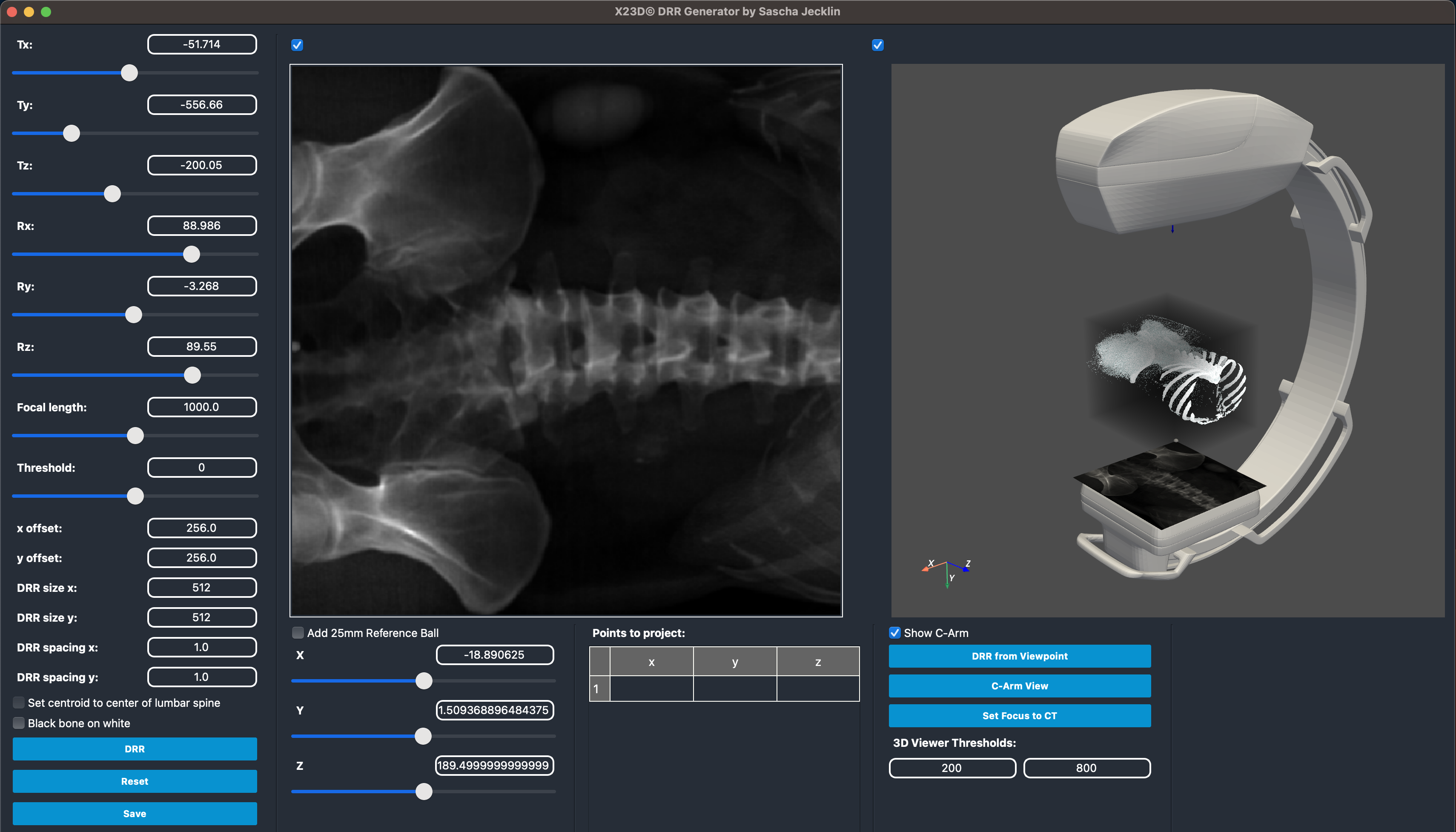 DRR Generation UI